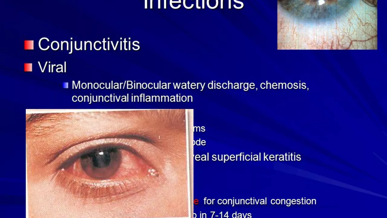 The impact of climate change on the prevalence of allergic conjunctivitis